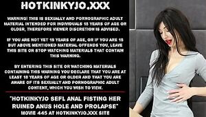 Hotkinkyjo sefl anal fisting her ruined anus hole and prolapse